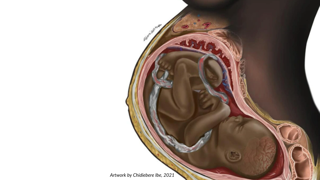 An illustration (by Chidiebere Ibe) of a black fetus in utero sparked a conversation about representation in healthcare.