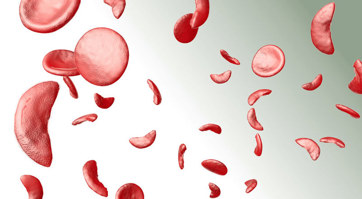 illustration of sickled blood cells